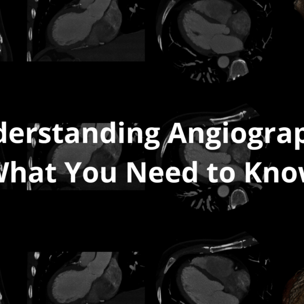 angiography