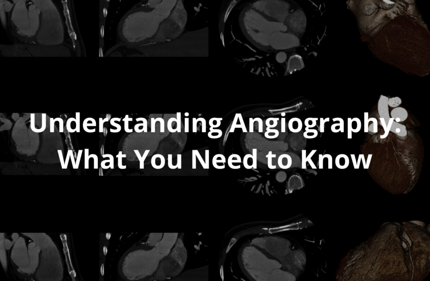 angiography