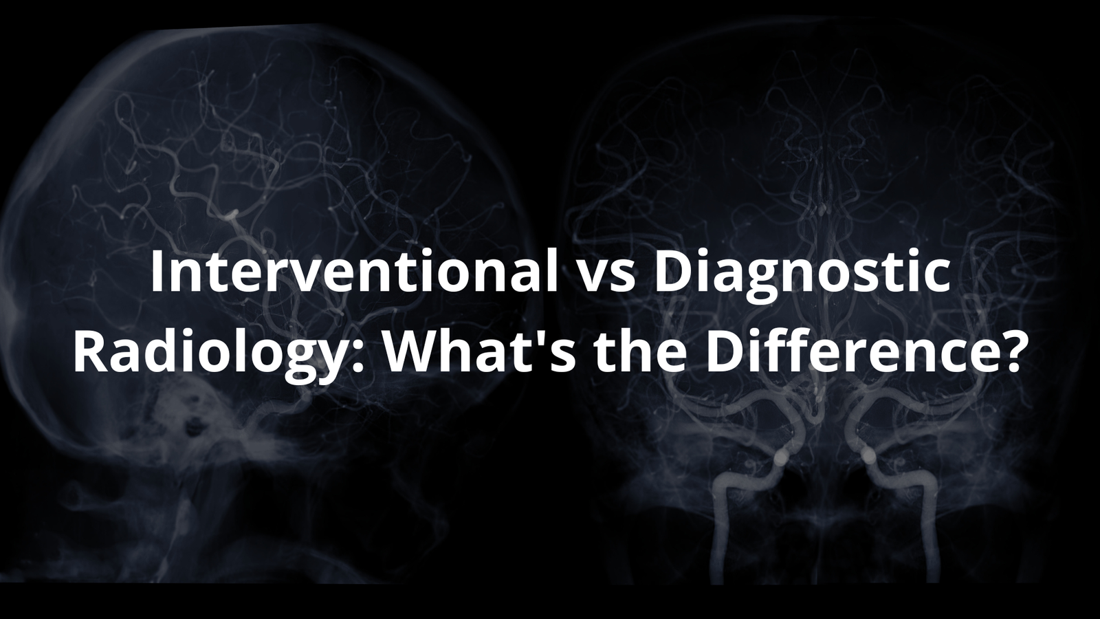 interventional vs diagnostic