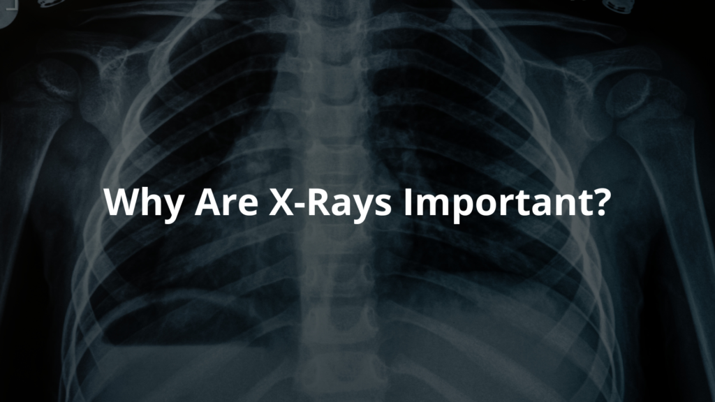 Diagnostic X-Rays