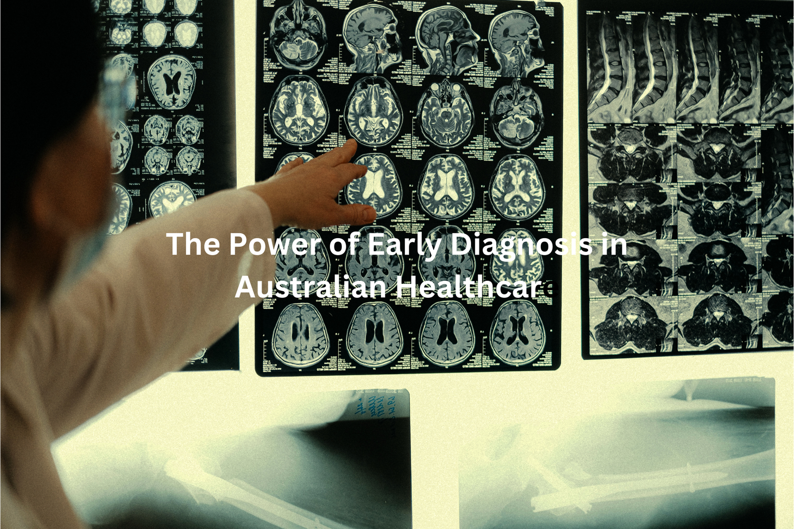 A medical professional examining a series of brain MRI images, highlighting the role of advanced imaging techniques in facilitating early diagnosis.