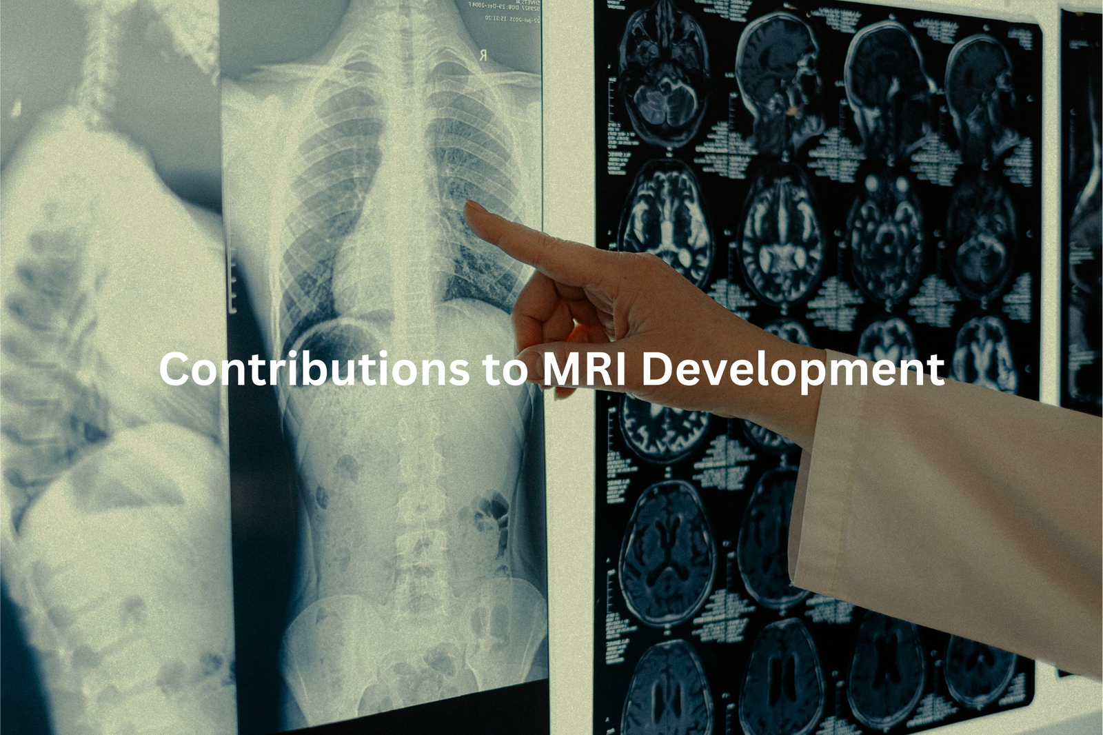 A hand pointing at MRI scans displayed on a computer screen indicating the role of advanced medical imaging in advancing medical knowledge and treatment