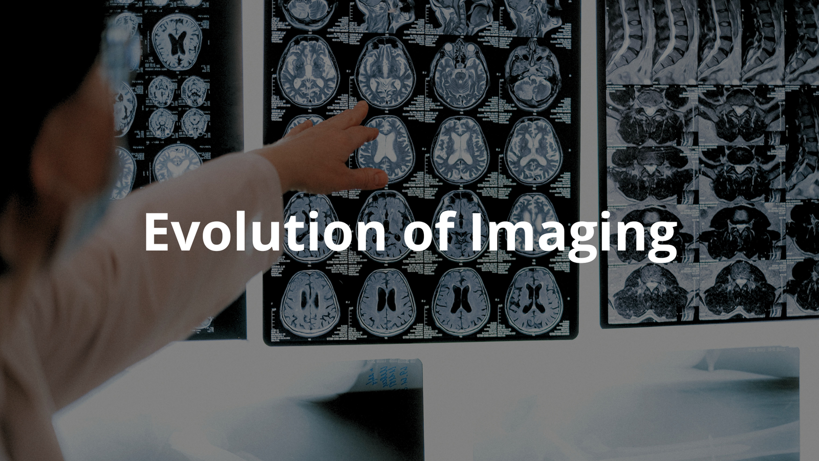 The Evolution of Imaging: A Journey Through Time