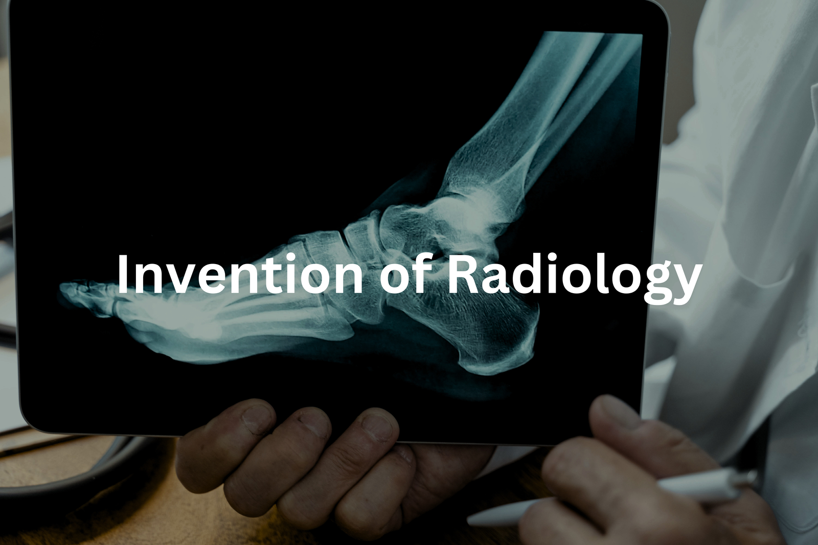 The Invention of Radiology: A Glimpse into Medical Imaging