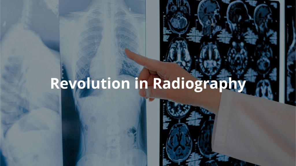 The Digital Revolution in Radiography