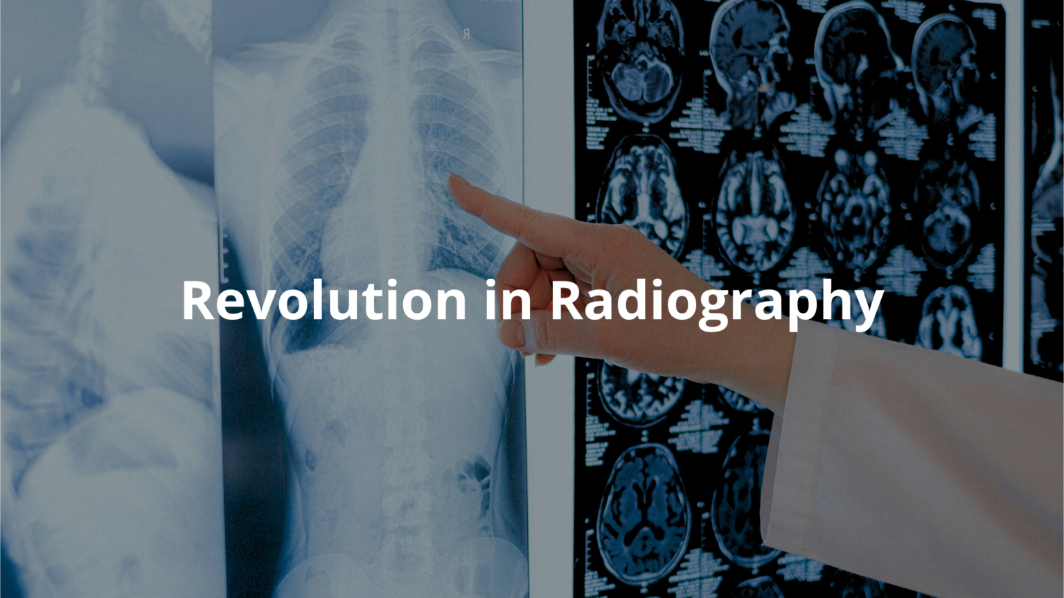 The History of X-Rays: How They Changed Medicine Forever