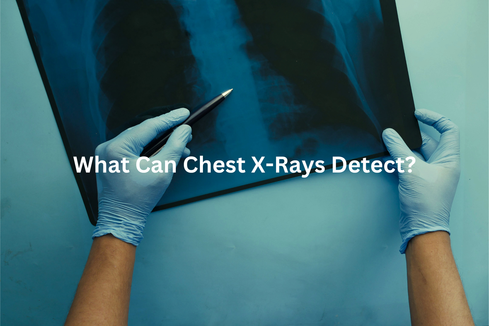 Close-up view of a chest X-ray with the question What Can Chest X-Rays Detect