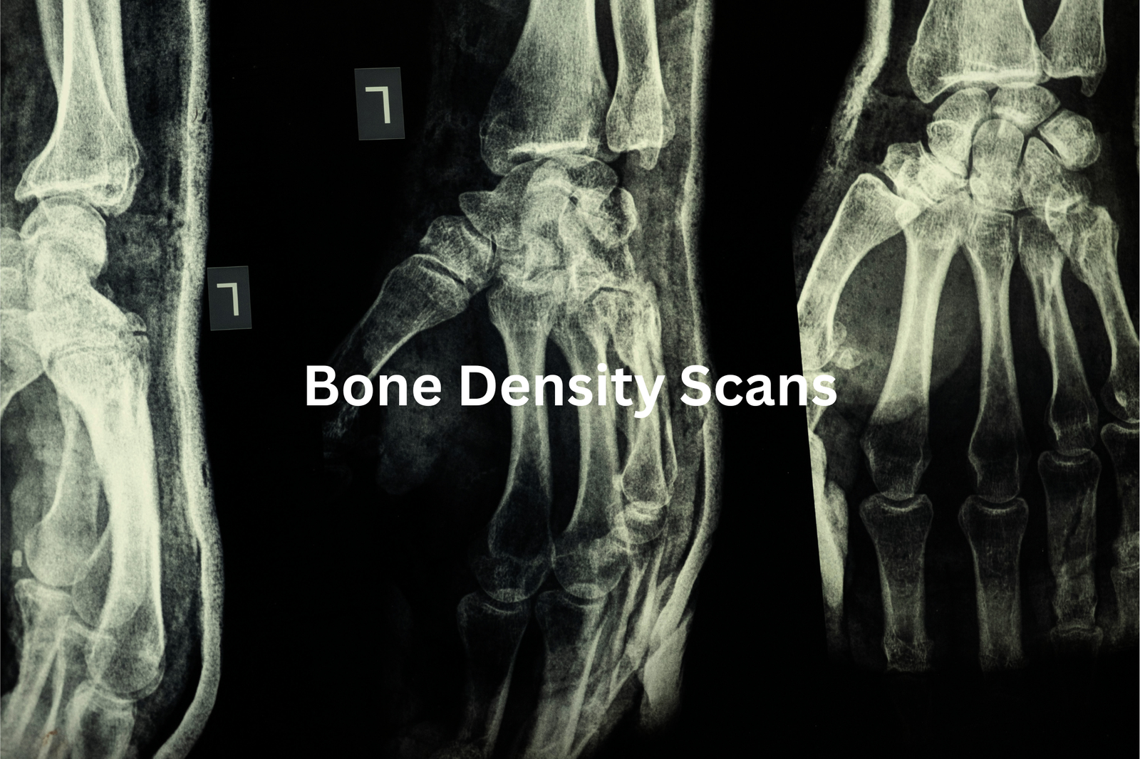 Bone Density Examination This medical imaging technique is used to assess the density and health of bones which can be important for diagnosing and monitoring conditions like osteoporosis