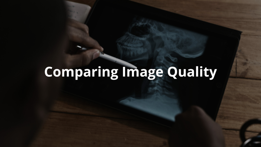 When comparing CT and MRI scans, it’s clear that both have their strengths.