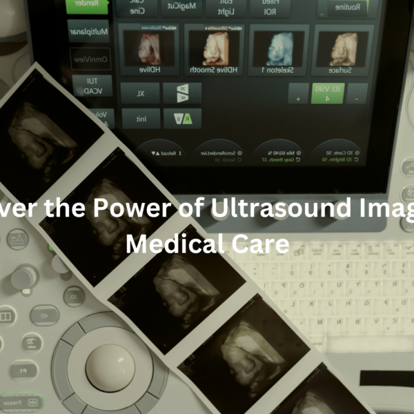 Medical ultrasound imaging equipment, including a monitor displaying ultrasound images and various controls and buttons for operation.