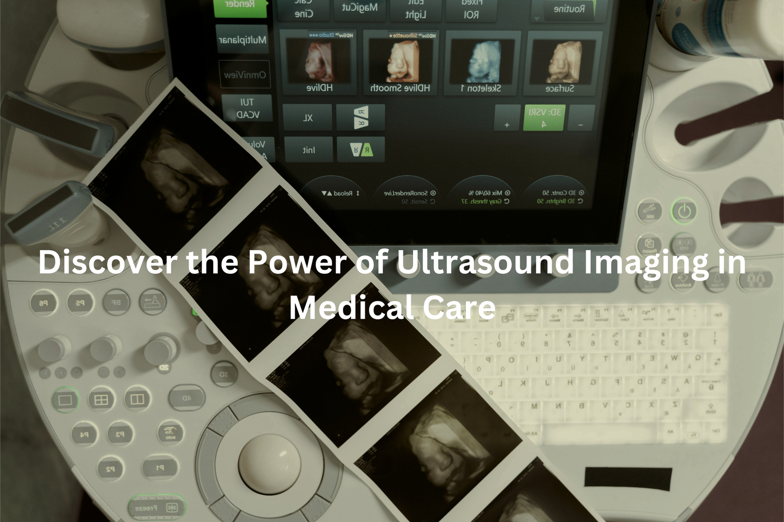 Medical ultrasound imaging equipment, including a monitor displaying ultrasound images and various controls and buttons for operation.