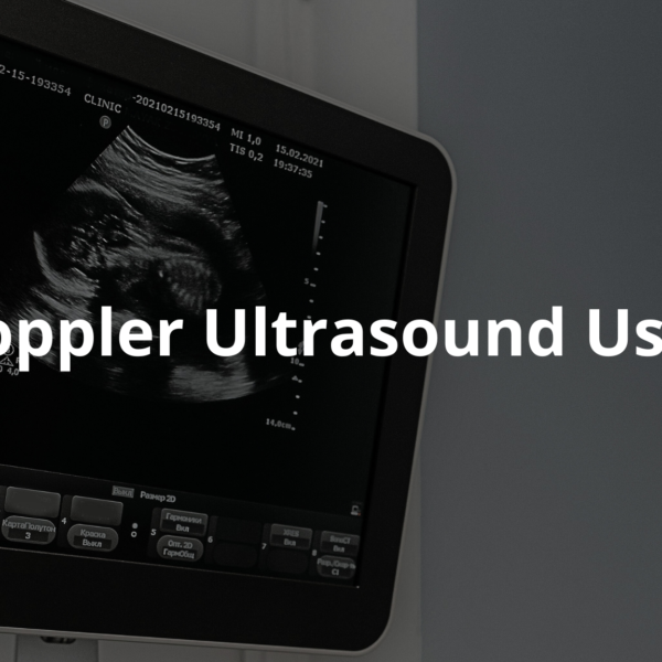 Learn about how Doppler ultrasound uses sound waves to check blood flow and help diagnose health issues.