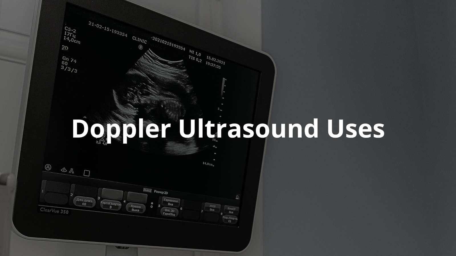 Learn about how Doppler ultrasound uses sound waves to check blood flow and help diagnose health issues.