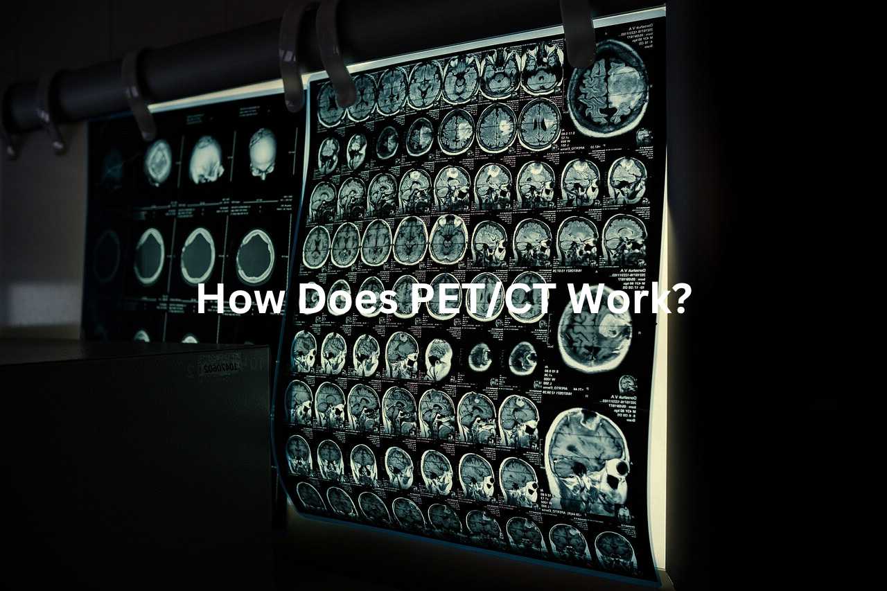 Exploring the Brains Intricate Networks through PETCT Technology