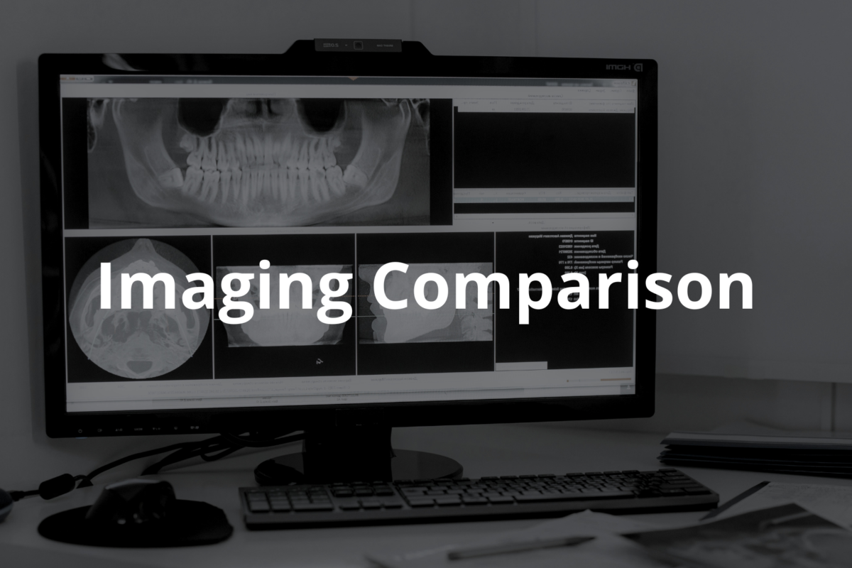 Imaging Comparison: Understanding CT and MRI Scans