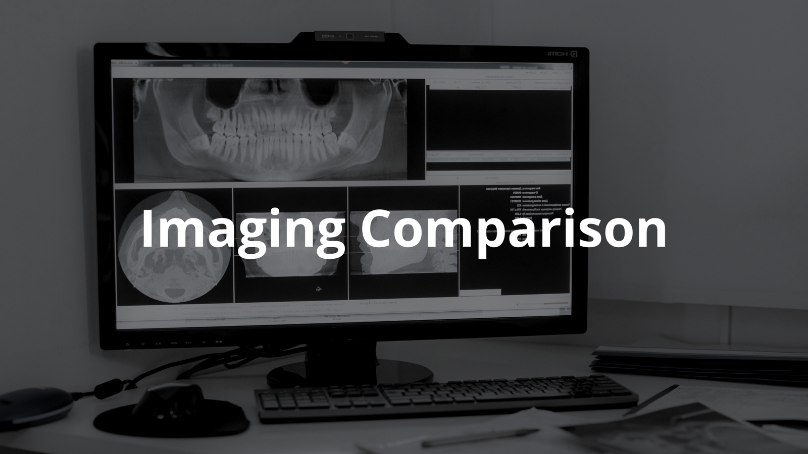 Imaging Comparison: Understanding CT and MRI Scans