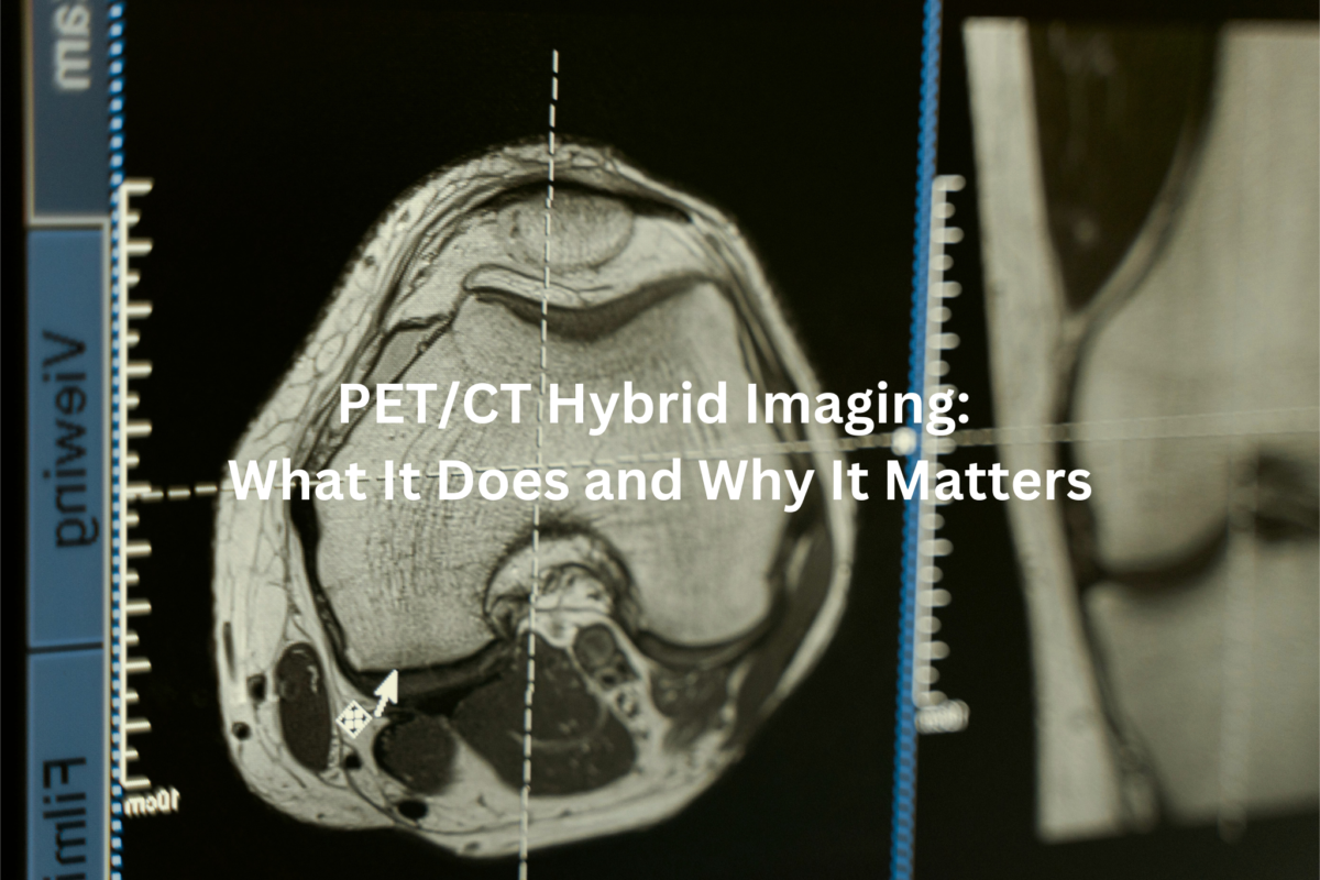 PET/CT Hybrid Imaging: What It Does and Why…