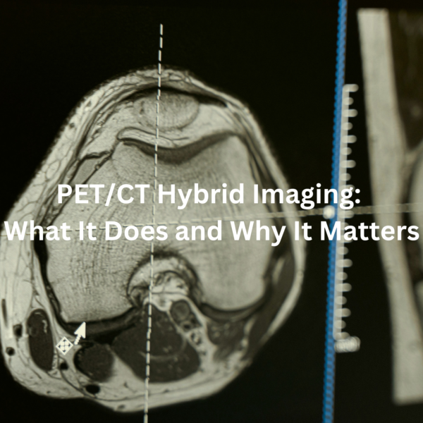 PET/CT Hybrid Imaging: What It Does and Why It Matters