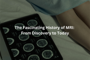 The Fascinating History of MRI: From Discovery to Today