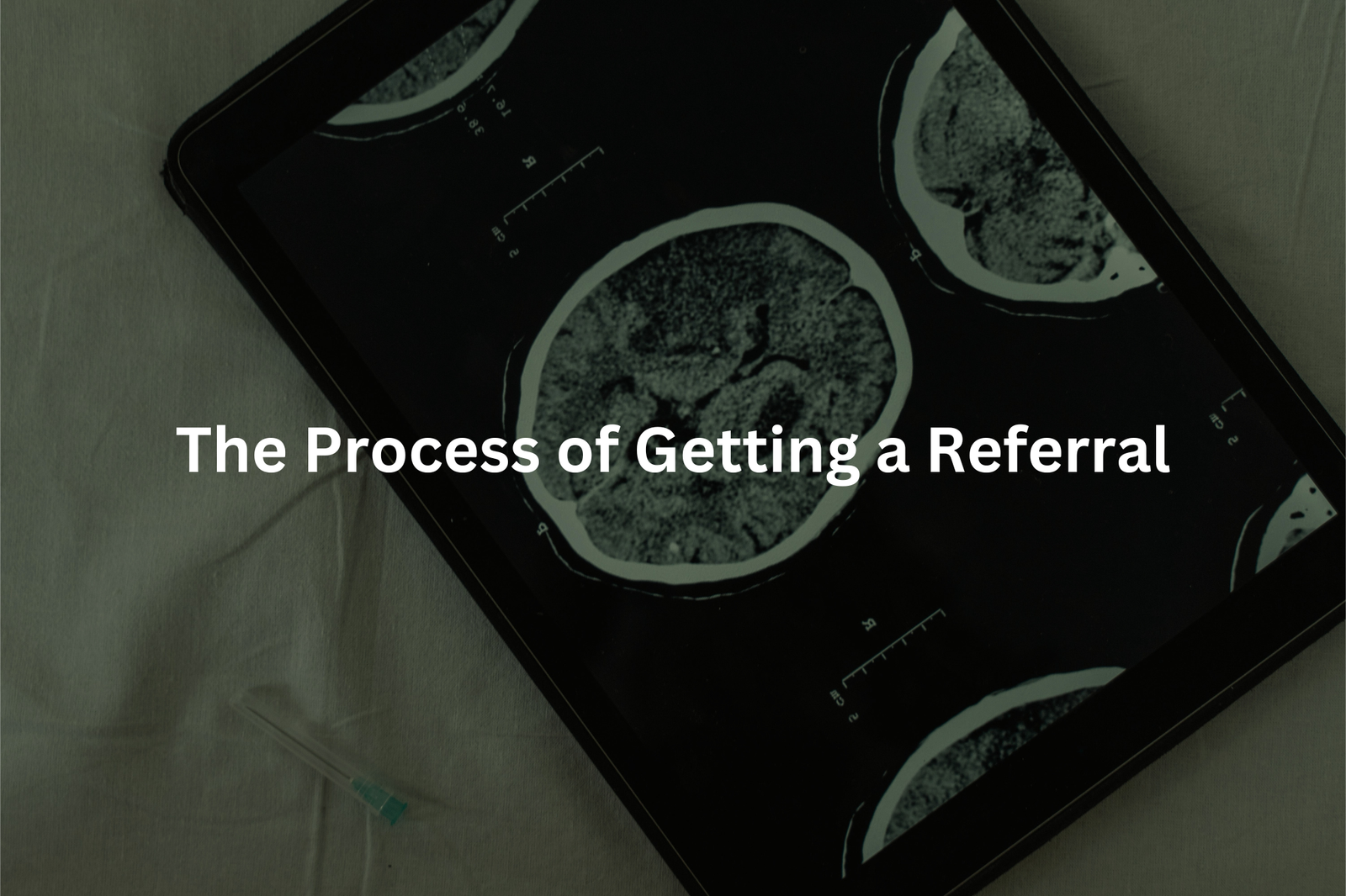 Healthcare Workflow The text The Process of Getting a Referral displayed over the medical scan suggests the importance of the referral process in the healthcare system