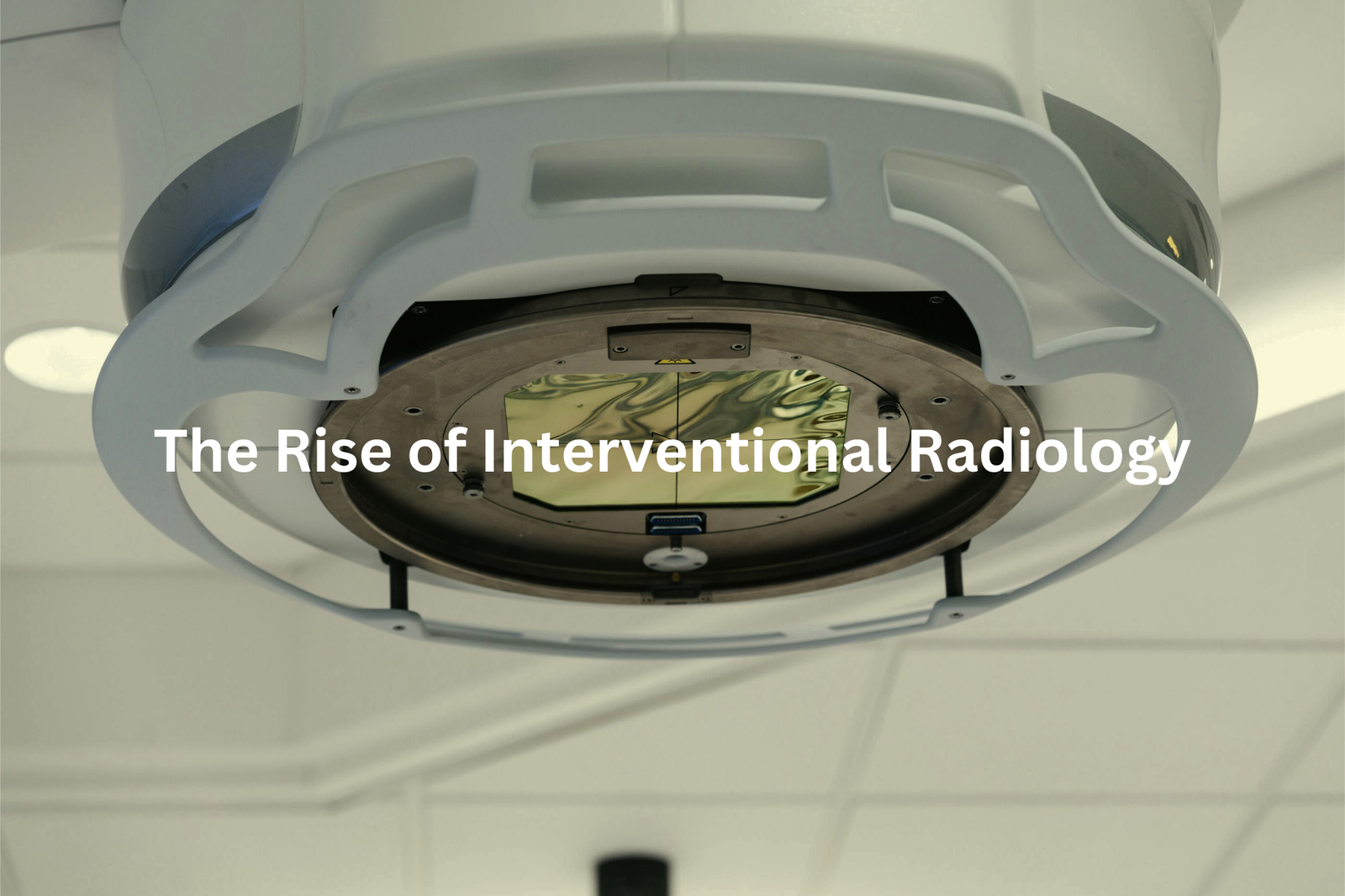 Detailed view of a radiological imaging machine highlighting the advancements in interventional radiology