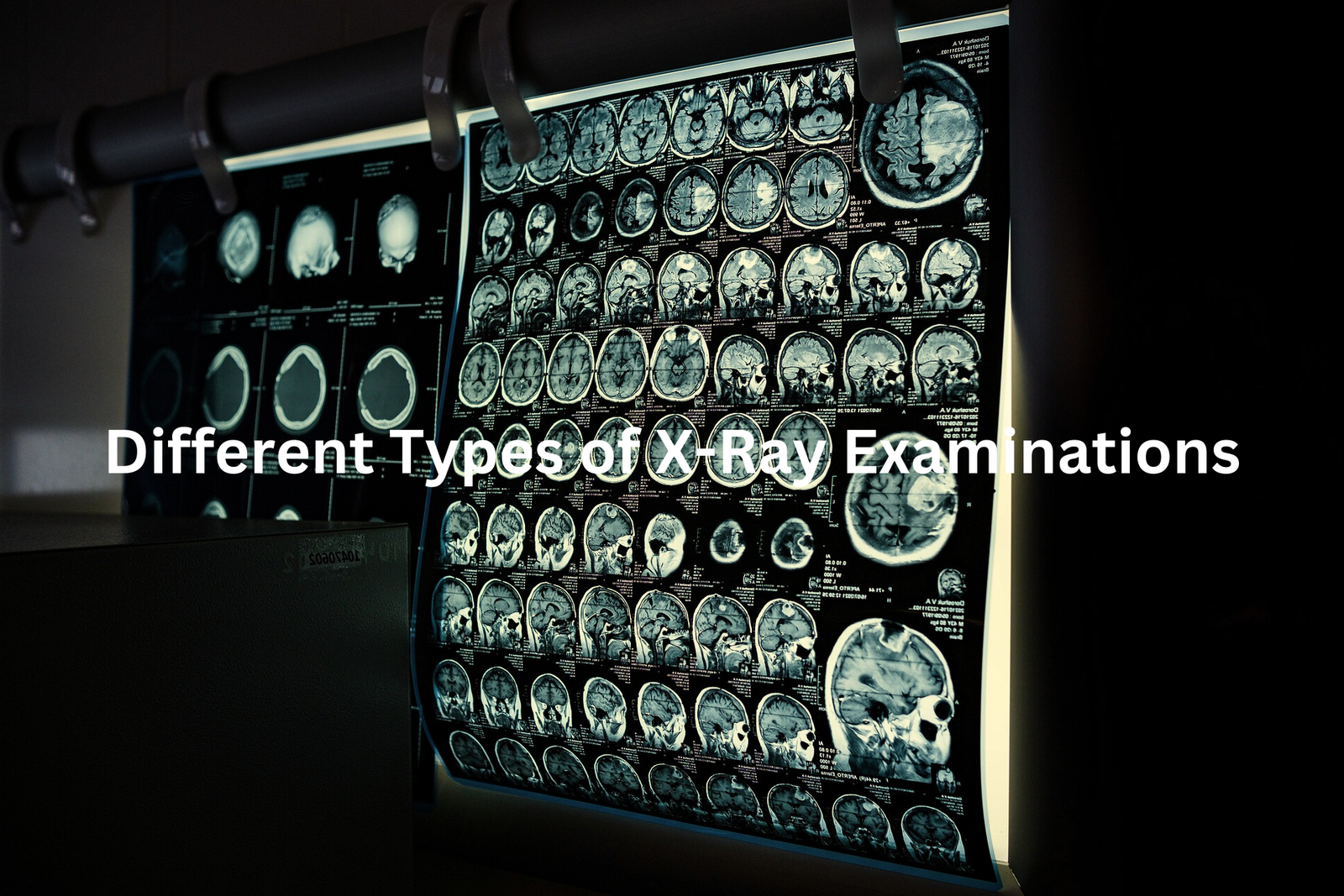 Comprehensive Collection of Radiographic Scans This image showcases a detailed display of various brain scans highlighting the diversity of diagnostic imaging techniques used in the medical field