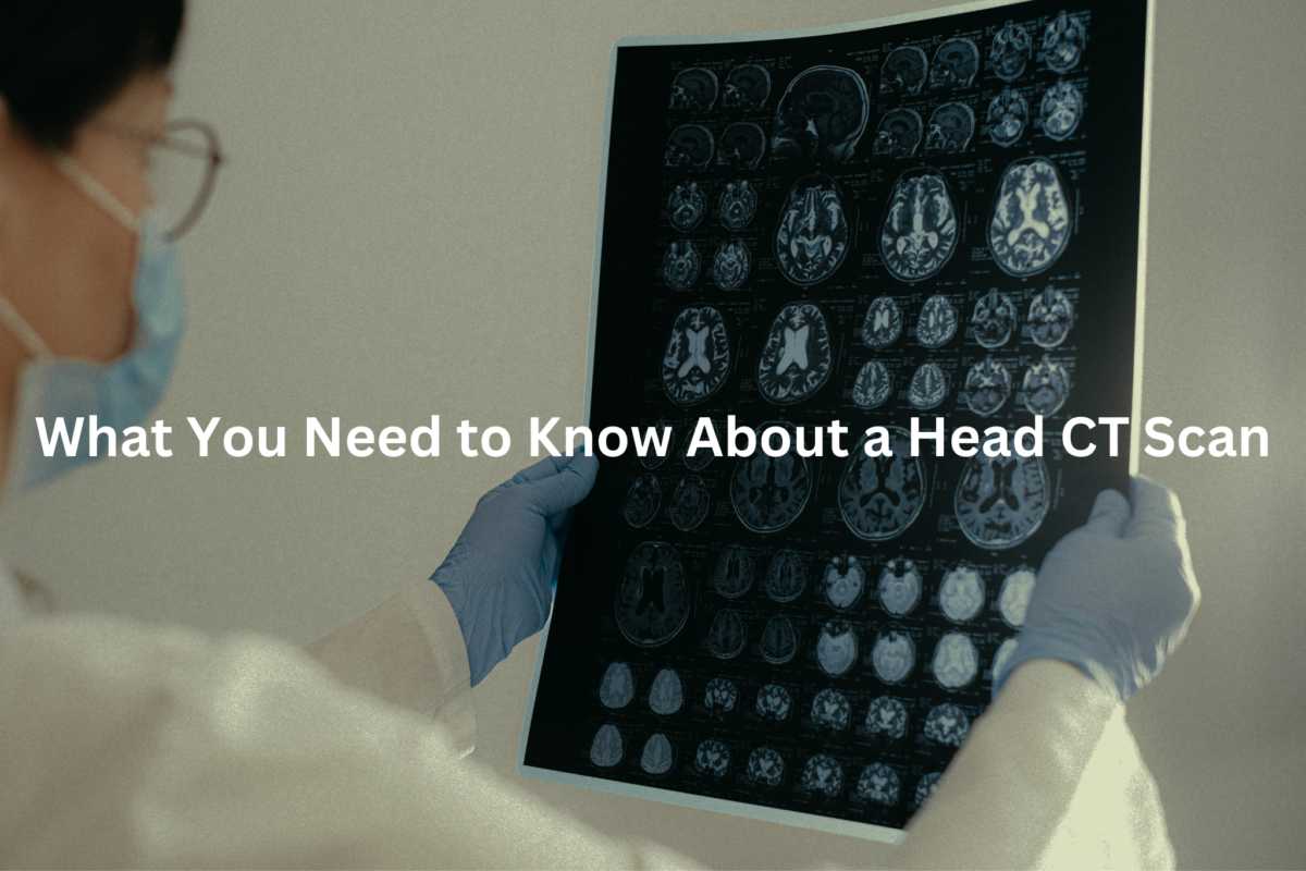 Close-up view of a series of medical brain scans displayed on a light box, with the text "Understanding the Insights from a Head CT Scan" as the alt text.