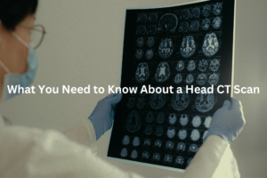 Close-up view of a series of medical brain scans displayed on a light box, with the text "Understanding the Insights from a Head CT Scan" as the alt text.