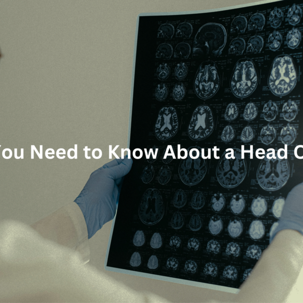 Close-up view of a series of medical brain scans displayed on a light box, with the text "Understanding the Insights from a Head CT Scan" as the alt text.