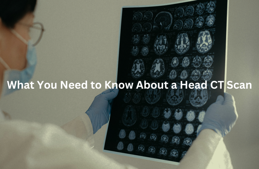 Close-up view of a series of medical brain scans displayed on a light box, with the text "Understanding the Insights from a Head CT Scan" as the alt text.