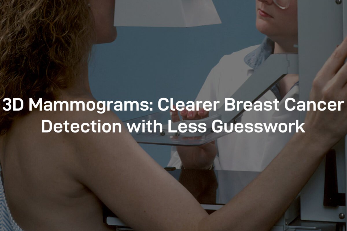 3D mammograms