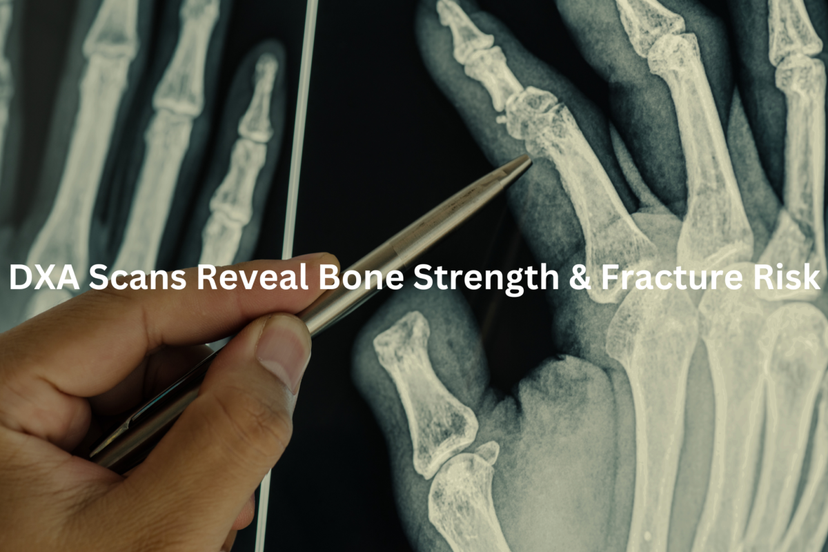 Diagnostic Image Revealing Bone Structure and Fracture Potential