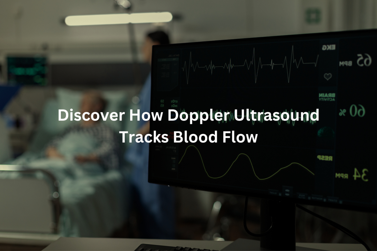 Medical display screen showing a Doppler ultrasound image used to track blood flow.