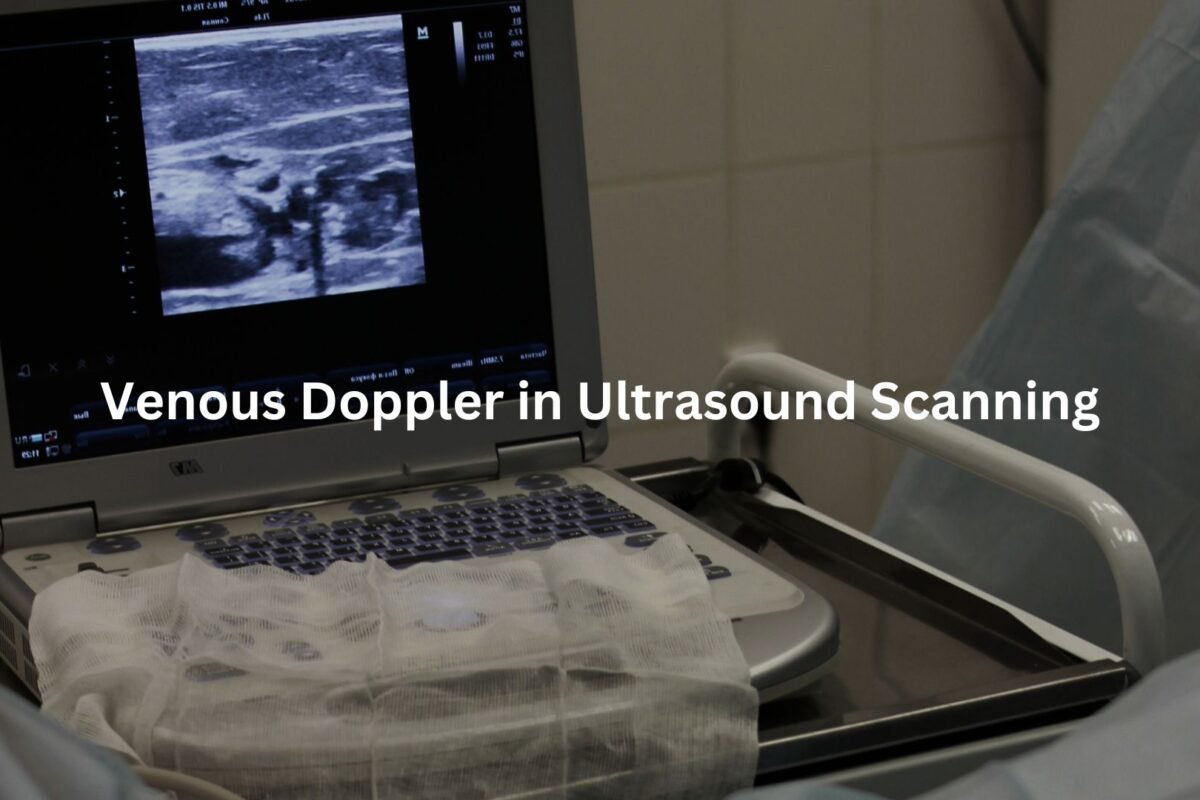 Venous Doppler in Ultrasound Scanning