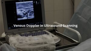 Venous Doppler in Ultrasound Scanning