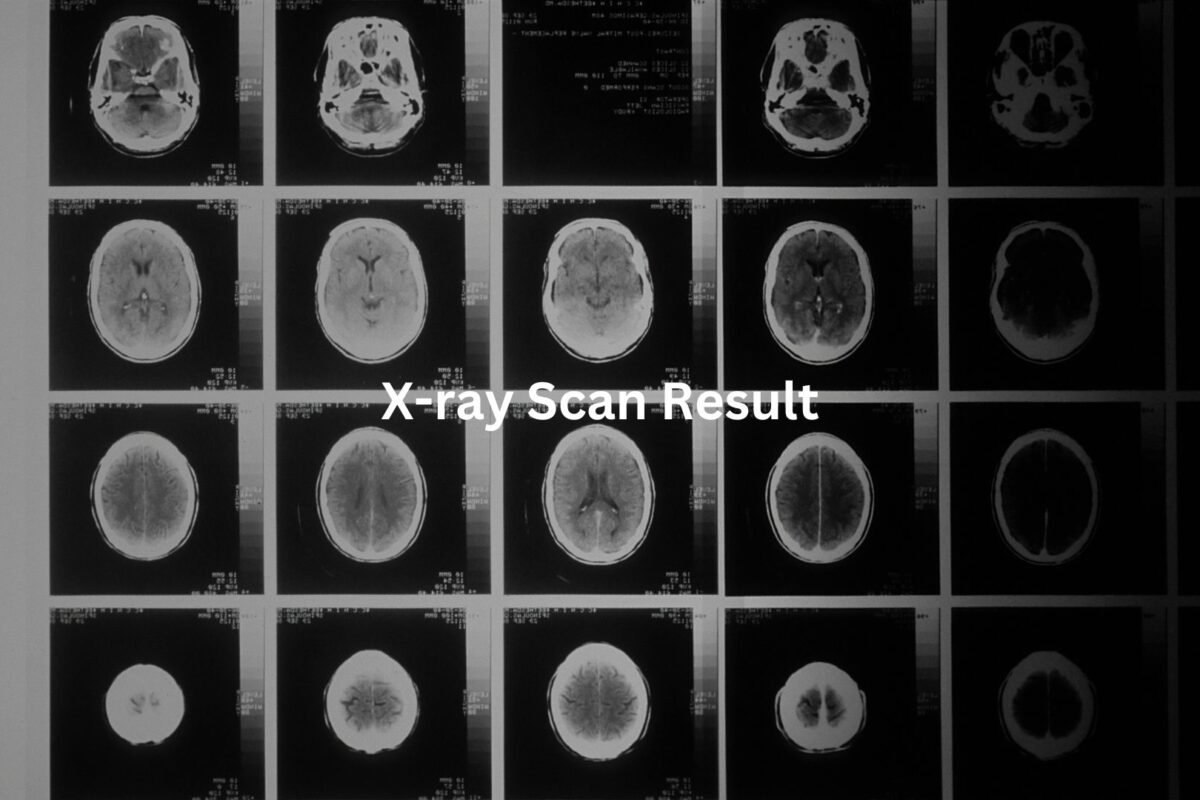 X-ray Scan Result