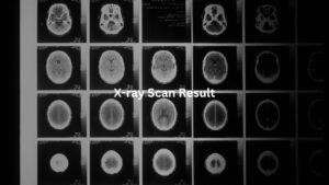 X-ray Scan Result