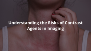 Risks of Contrast Agents